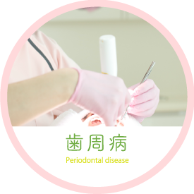 歯周病